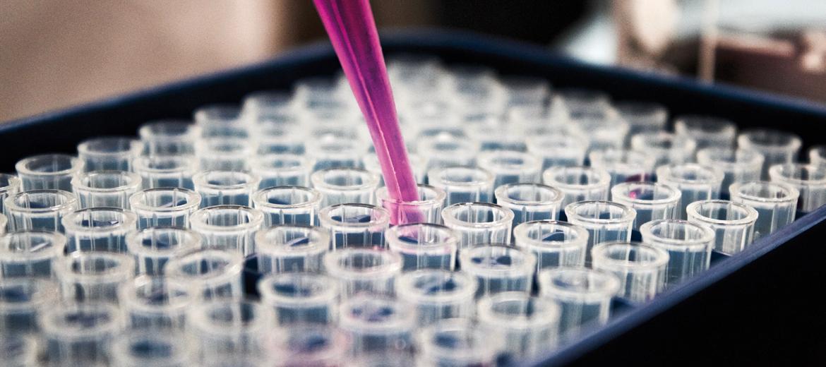 Pandemia, sistemi sanitari e ruolo della diagnostica