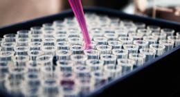 Pandemia, sistemi sanitari e ruolo della diagnostica