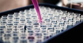 Pandemia, sistemi sanitari e ruolo della diagnostica