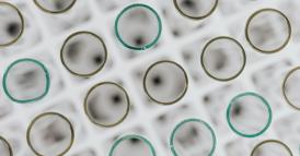 L&rsquo;efficace connubio tra Value-Based Healthcare e Human Centred Design